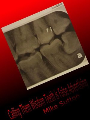 cover image of Calling them Wisdom Teeth is False Advertising